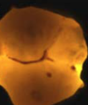 <p>uses visible light to illuminate tooth structure, allowing for the detection of caries and cracks based on the patterns of light passage</p>