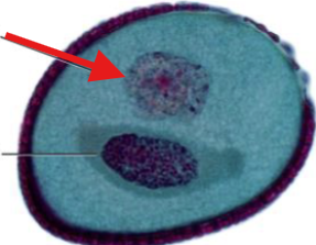 <p>What is being indicated on the Lilium Pollen Grain?</p>