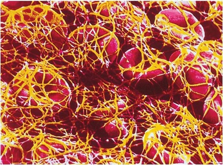 <p>insoluble, filamentous protein that forms the structure of a blood clot</p>