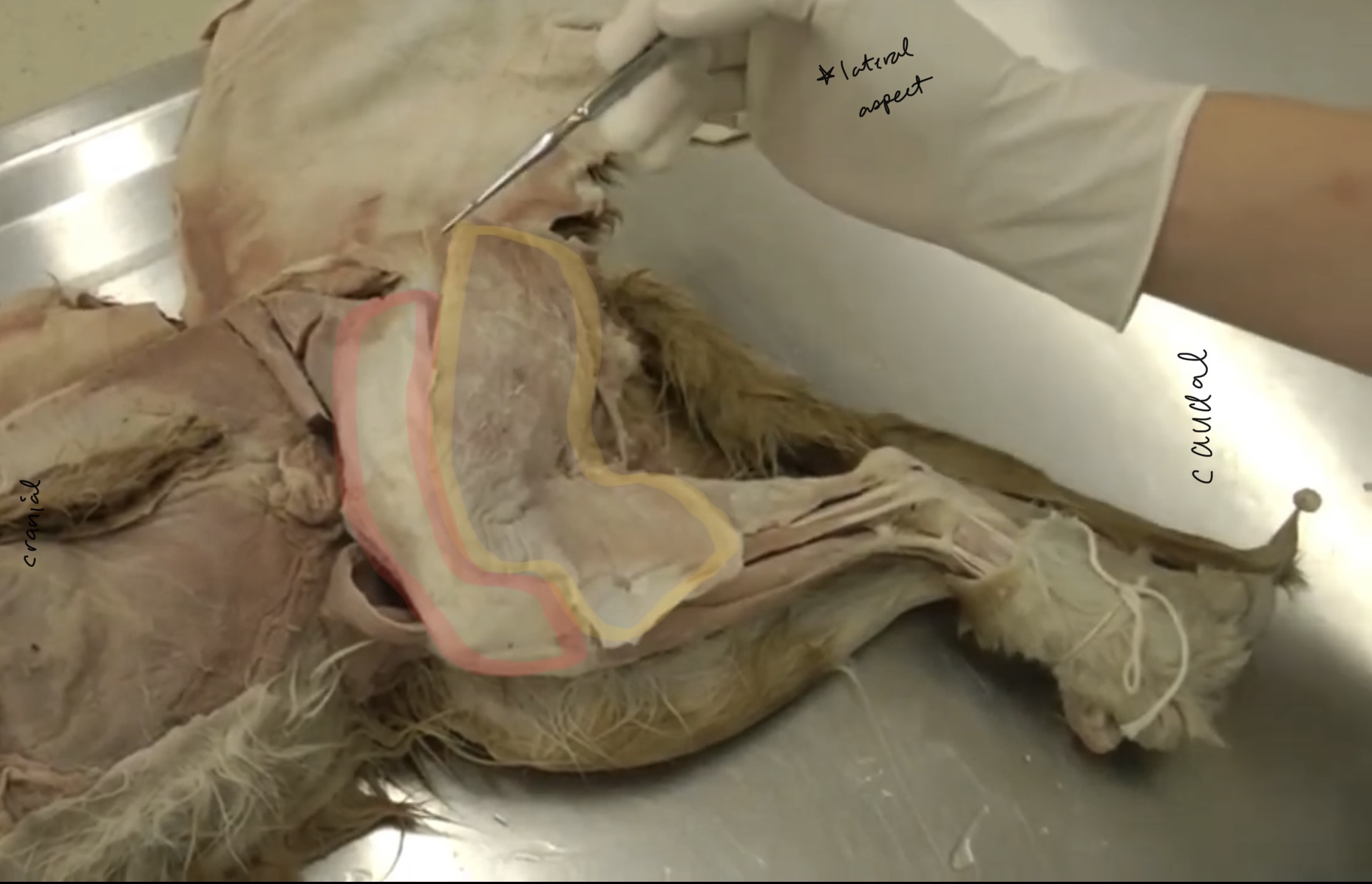 <p>What is the yellow highlighted muscle?</p>