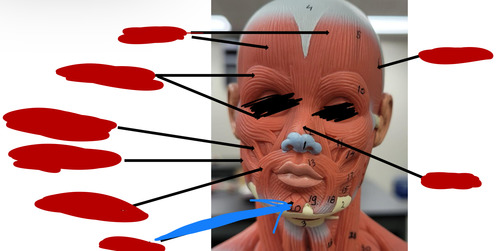 <p>What muscle is this?</p>