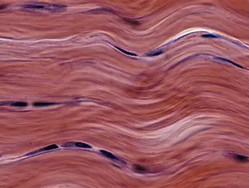 <p>dense fibrous connective tissue</p>