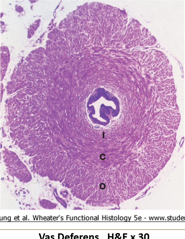 <ul><li><p class=""><strong>Lined with pseudostratified epithelium</strong> with <strong>stereocilia</strong></p></li><li><p class=""><strong>Thick muscularis</strong>: inner circular, middle spiral, outer longitudinal</p></li><li><p class="">Lumen appears <strong>stellate-shaped</strong> (star-like) except in the ampulla</p></li></ul><p></p>
