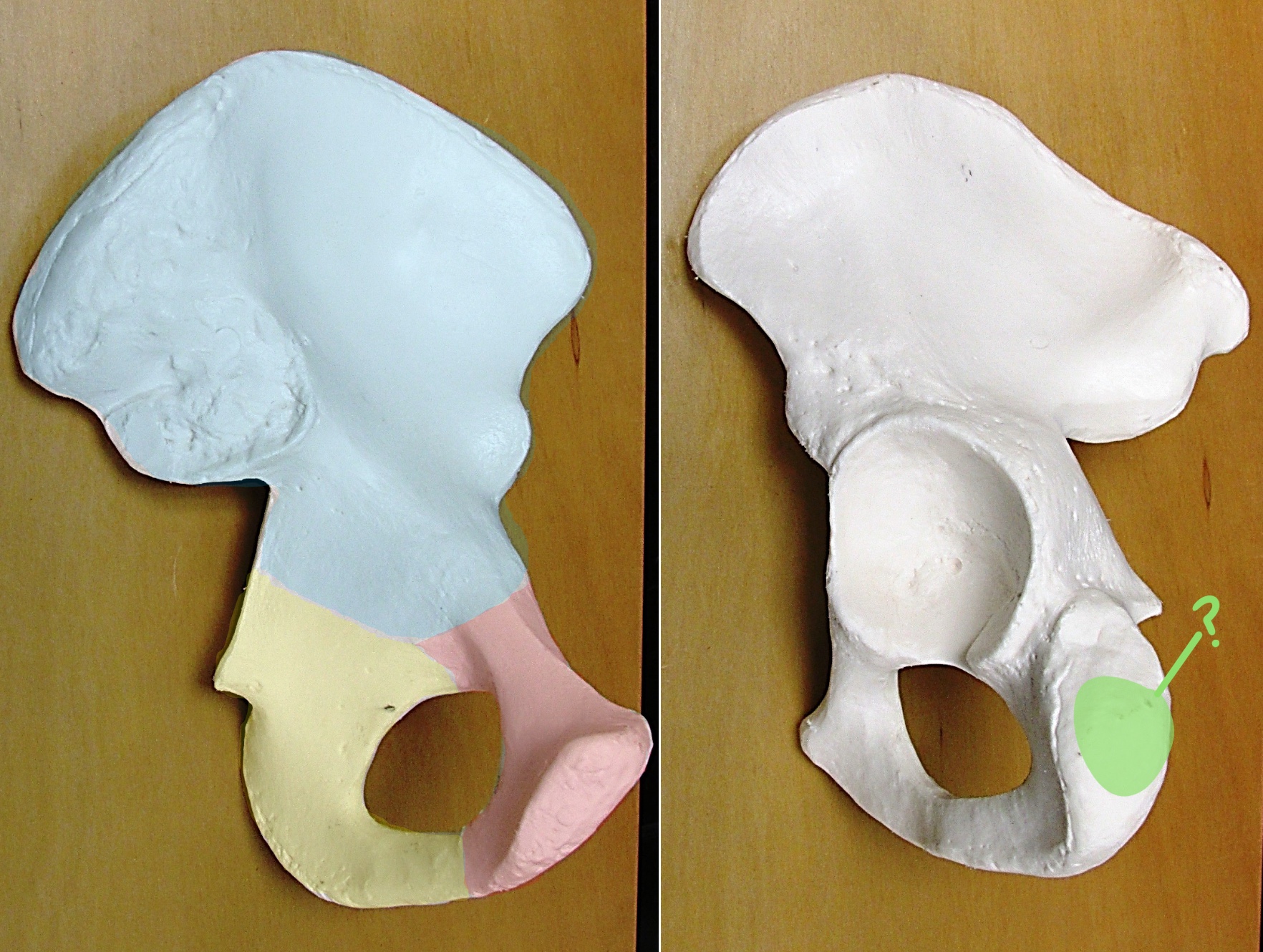 <p>Determine the part of the Coxa highlighted</p>