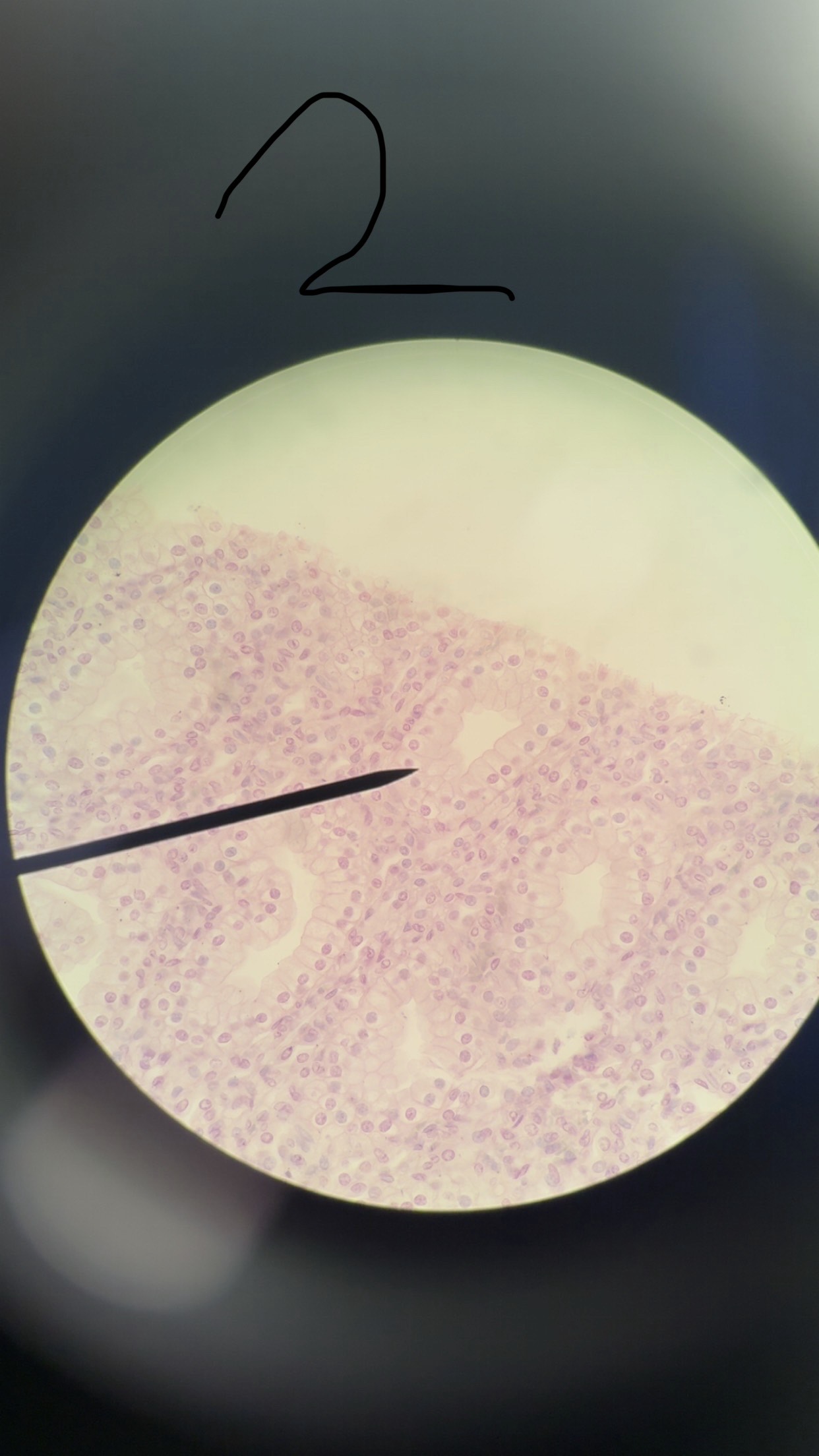 <p>Simple cuboidal epithelium</p>