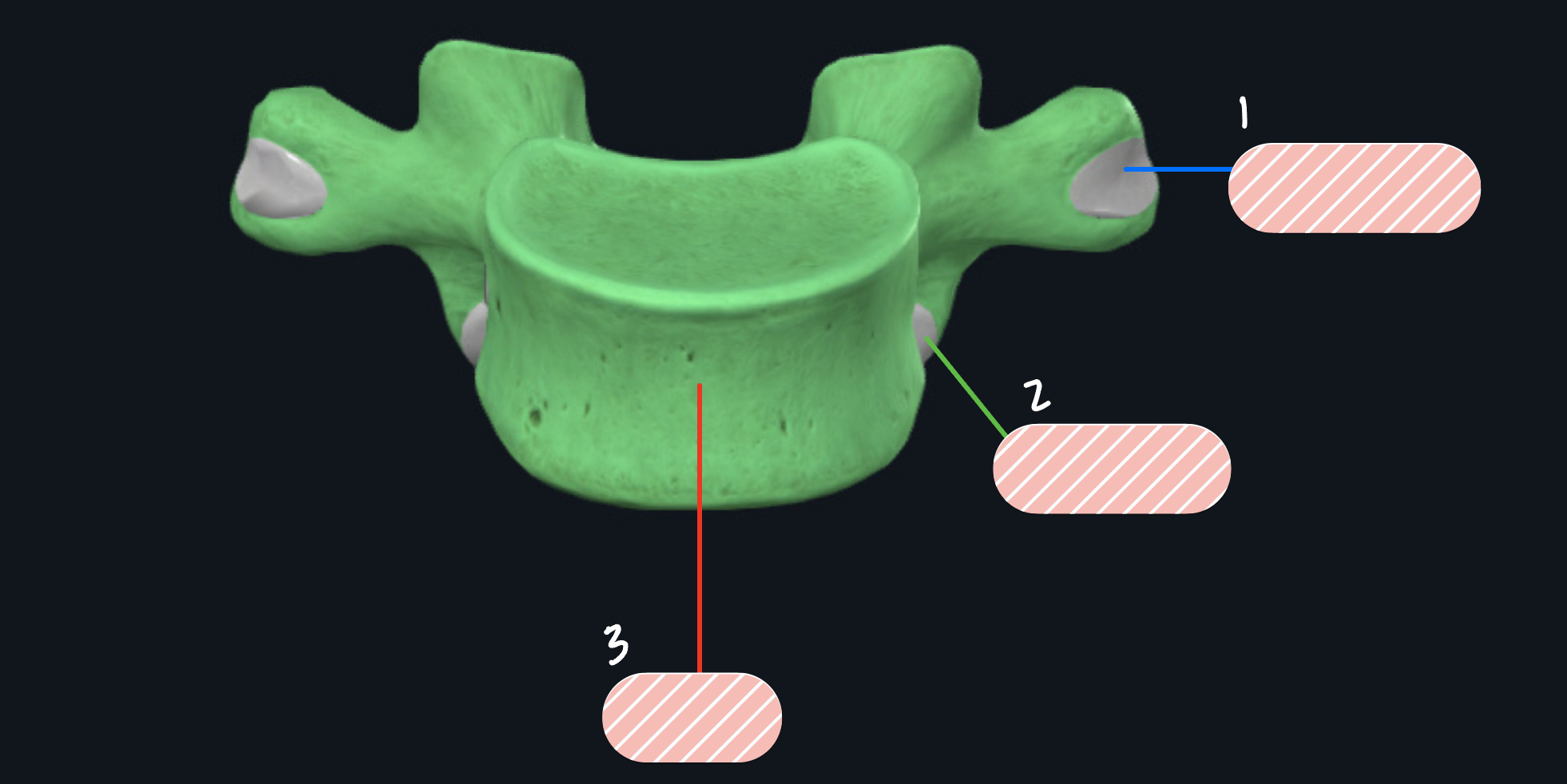 <p>What vertebra is this?</p>