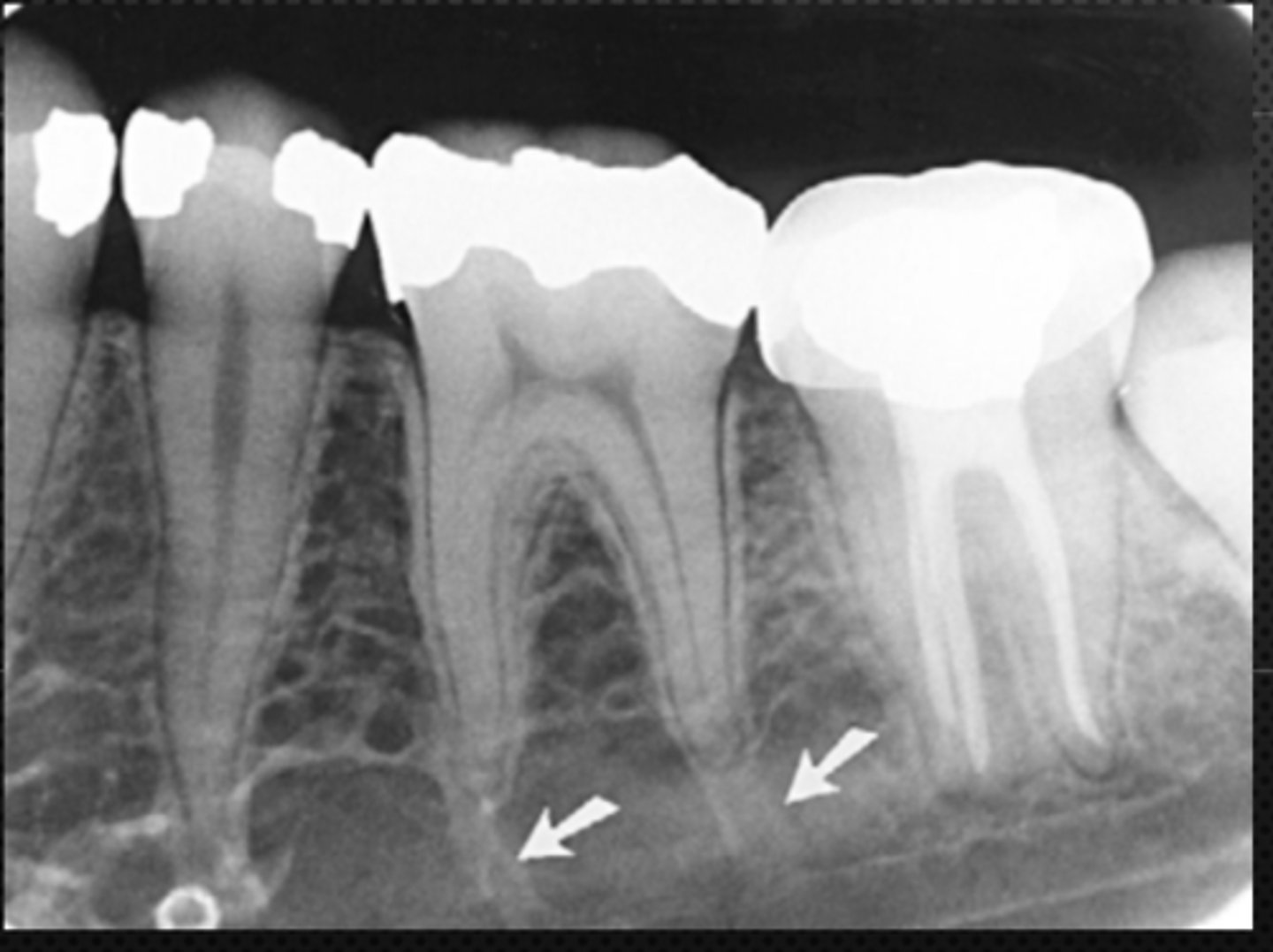 <p>Identify the radiolucent structure</p>