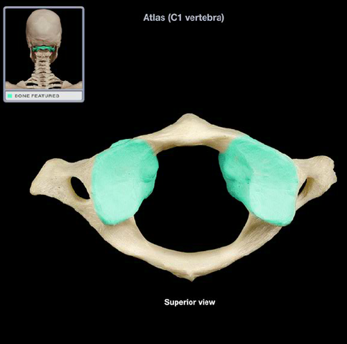 the bony junction between the superior and inferior articular processes, separated medially from the lamina by the medial facet line