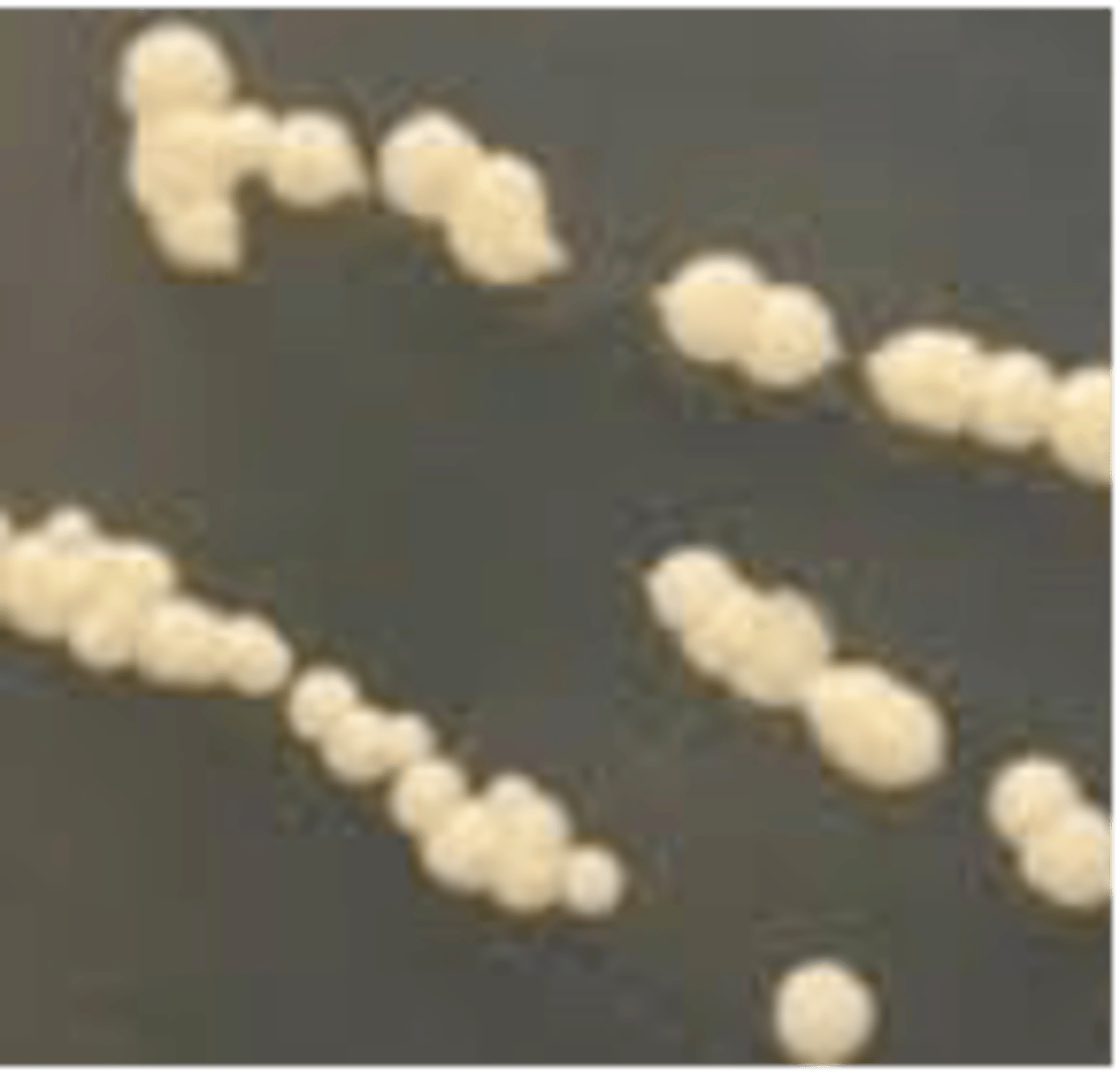 <p>what Mycobacterium spp. is indicated in this image that affects domestic poultry</p>