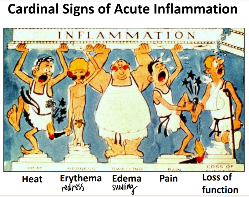 <p>heat </p><p>redness (erythema) </p><p>swelling (edema) </p><p>pain </p><p>loss of function </p>