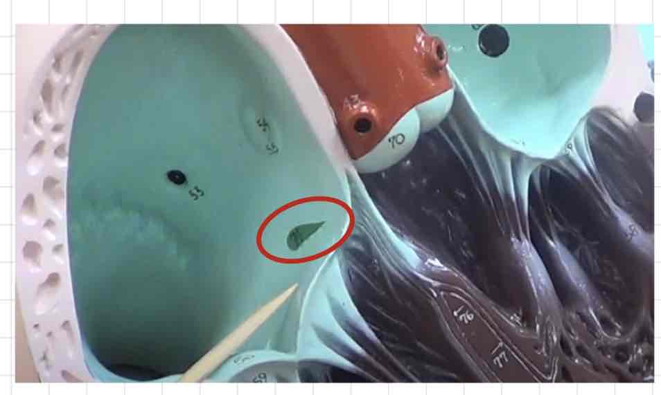 <p>what is this? (giant heart model)</p>