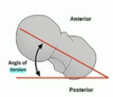 <p>posterior</p>