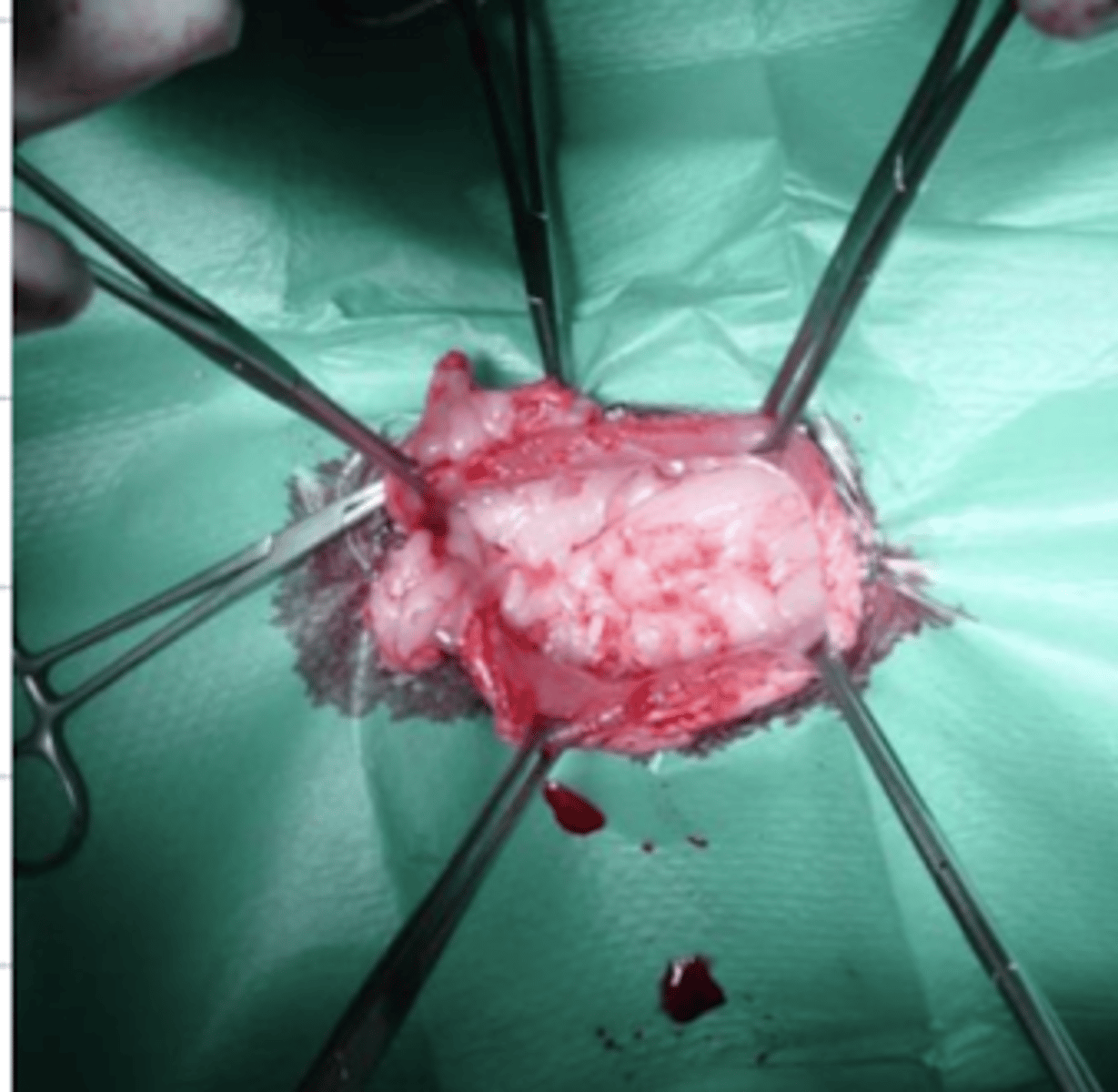 <p>¿cual instrumento está utilizado para sujetar tejido que vamos a quitar del paciente?</p>