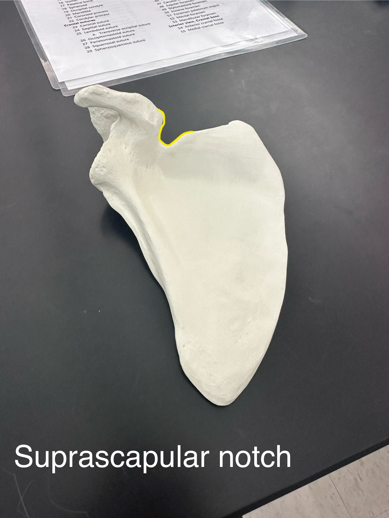 <p>Supra-scapular notch</p>
