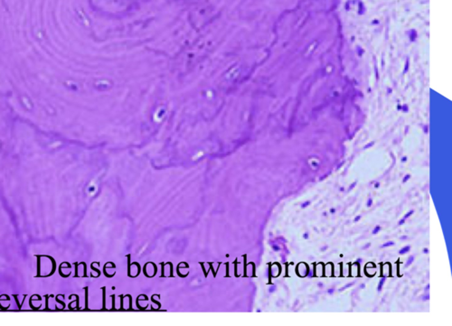 <p>- Reversal lines</p>