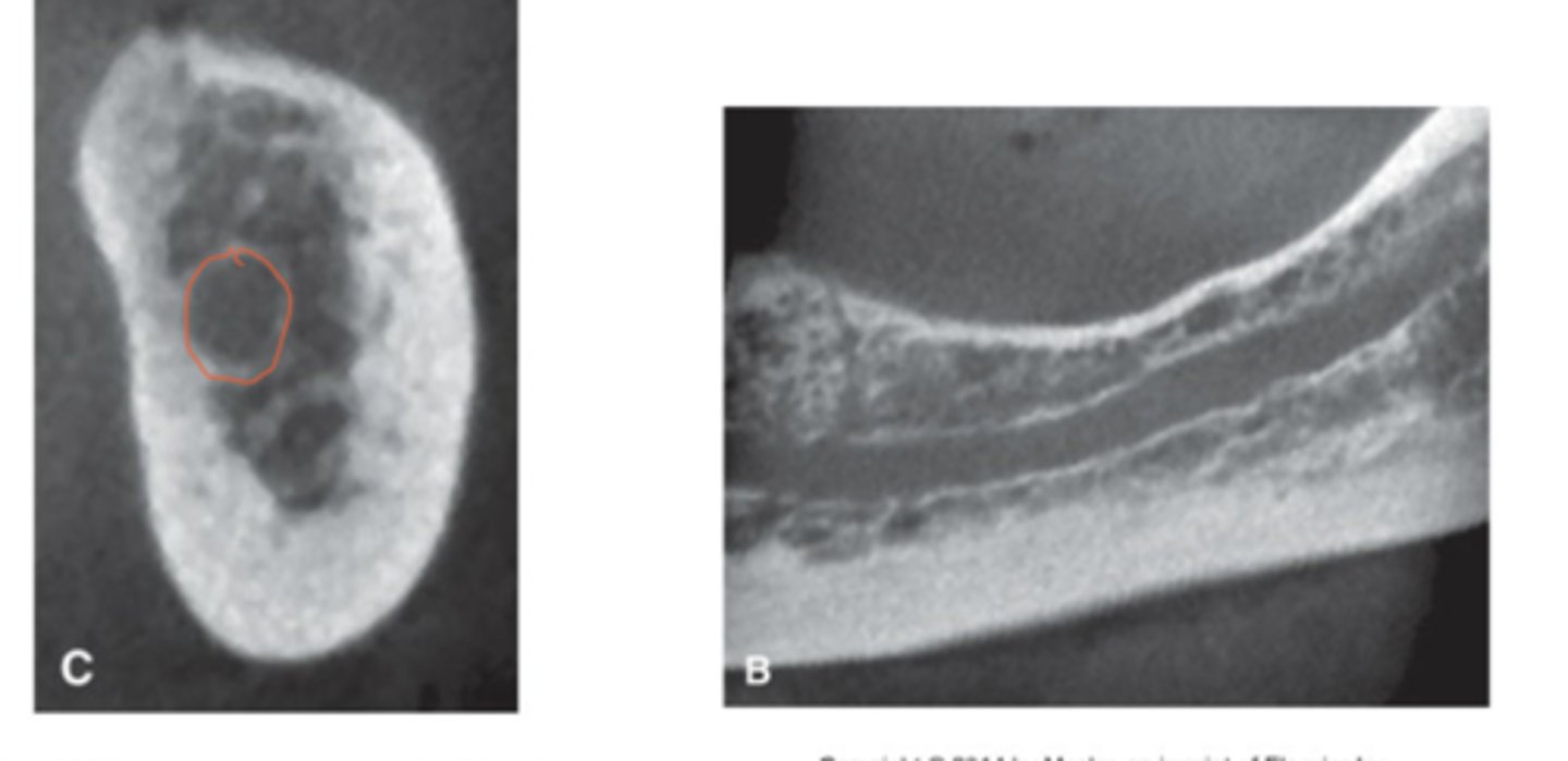 <p>cone beam computed tomography (CT) scans and high definition panoramic radiographs</p>