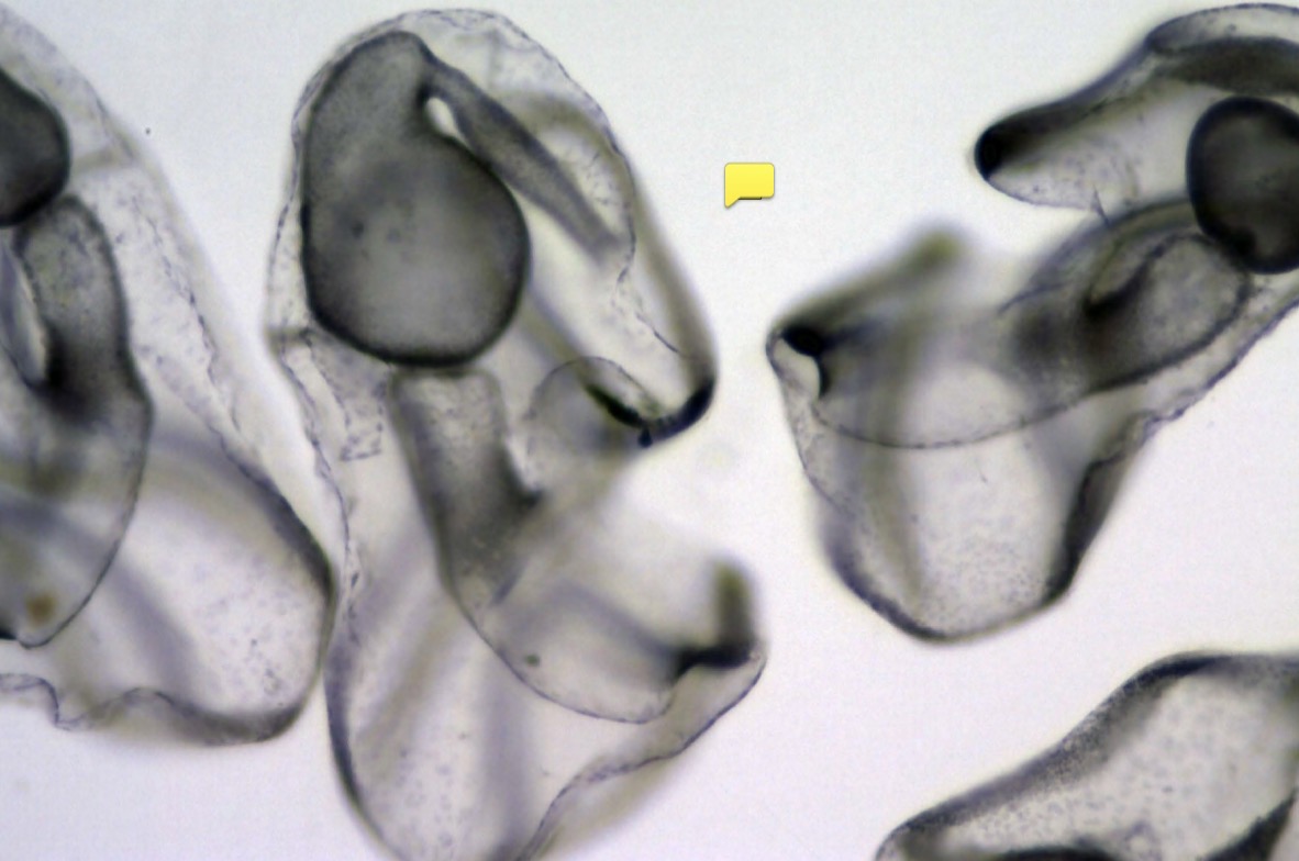 <p>which starfish development stage?</p>