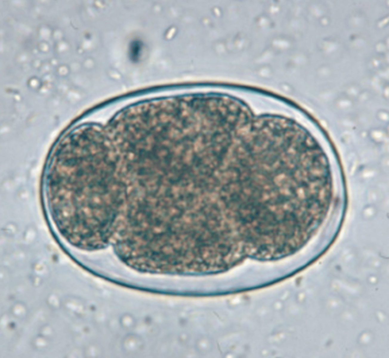 <p>what ectoparasite is seen in this image?</p>