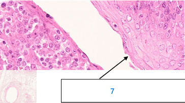 <p>7 amygdales palatines </p>