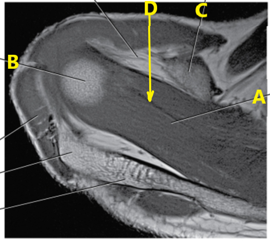<p>What is letter A pointing to ?</p>