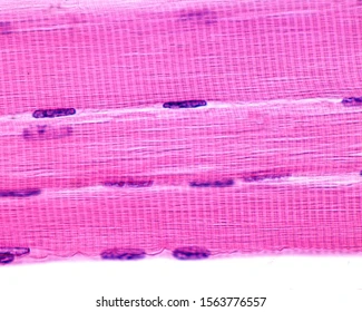 <ul><li><p>Consists of long, cylindrical, striated fibers&nbsp;</p></li></ul><p>→ Vary greatly in length &amp; have multiple nuclei &amp; mitochondria</p><ul><li><p><strong><u><mark data-color="yellow" style="background-color: yellow; color: inherit;">Location:</mark></u></strong> usually attached to bones via tendons&nbsp;</p></li><li><p><strong><u><mark data-color="yellow" style="background-color: yellow; color: inherit;">Function:</mark></u></strong> motion, posture, heat production, &amp; protection</p></li></ul><p></p>