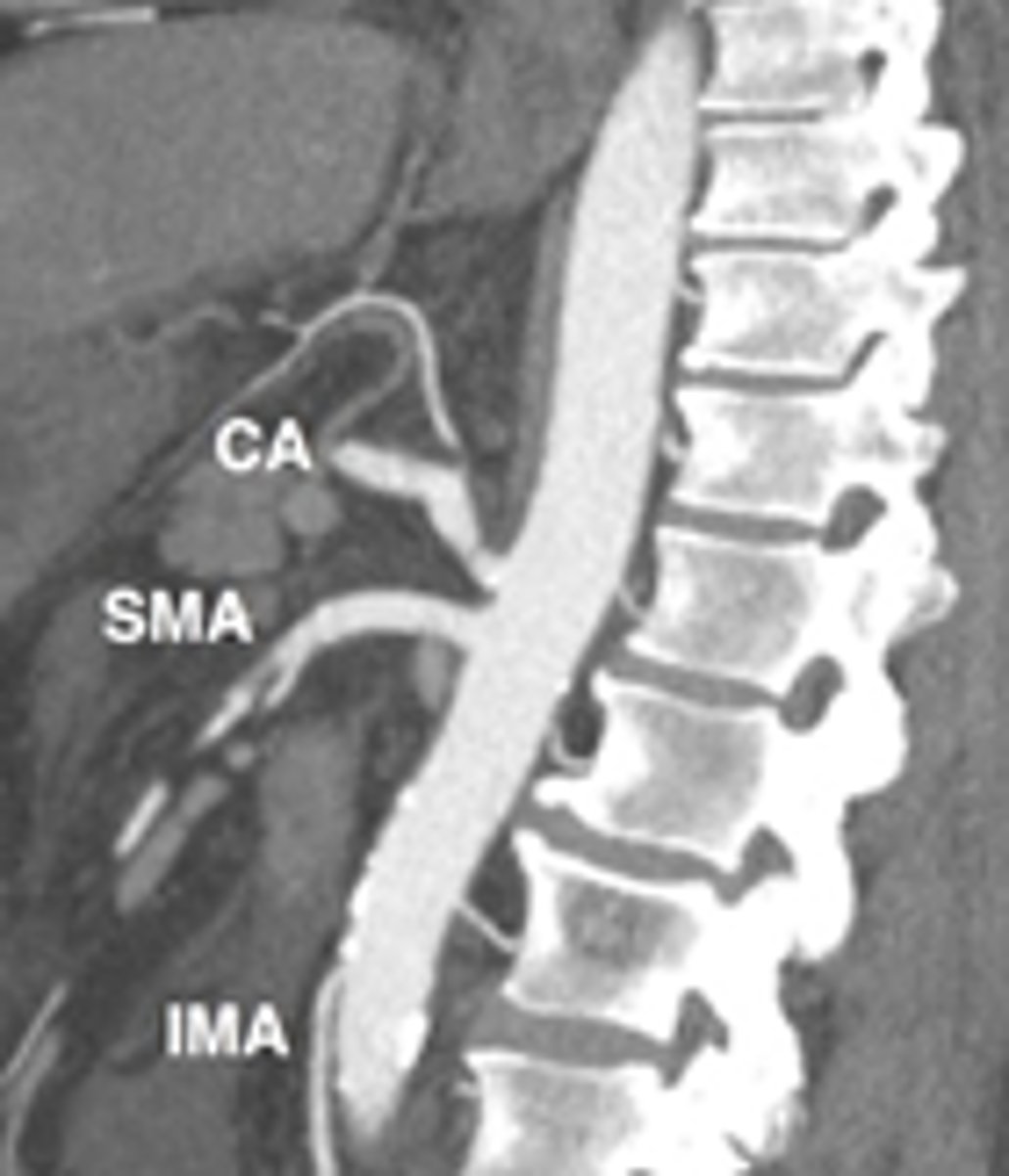 <p>Duplex US (+/- CTA or CTA wIVC)</p><p>Tx: Behavior mod, antiplatelet therapy, +/- revascularization if enough of an occlusion (refer to vascular surgeon) </p><p>FYI dx = Chronic Mesenteric Ischemia </p>