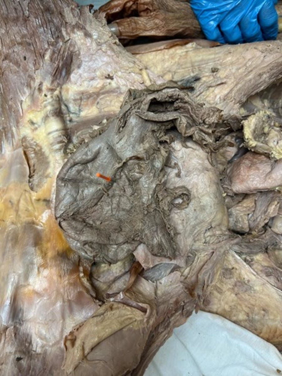 <p>body of stomach</p>