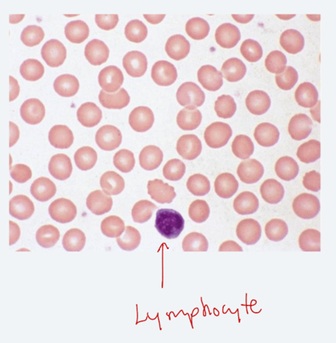 <p>1. same size as lymphocyte nucleus</p><p>2. central pallow = 1/3 cell diameter</p>