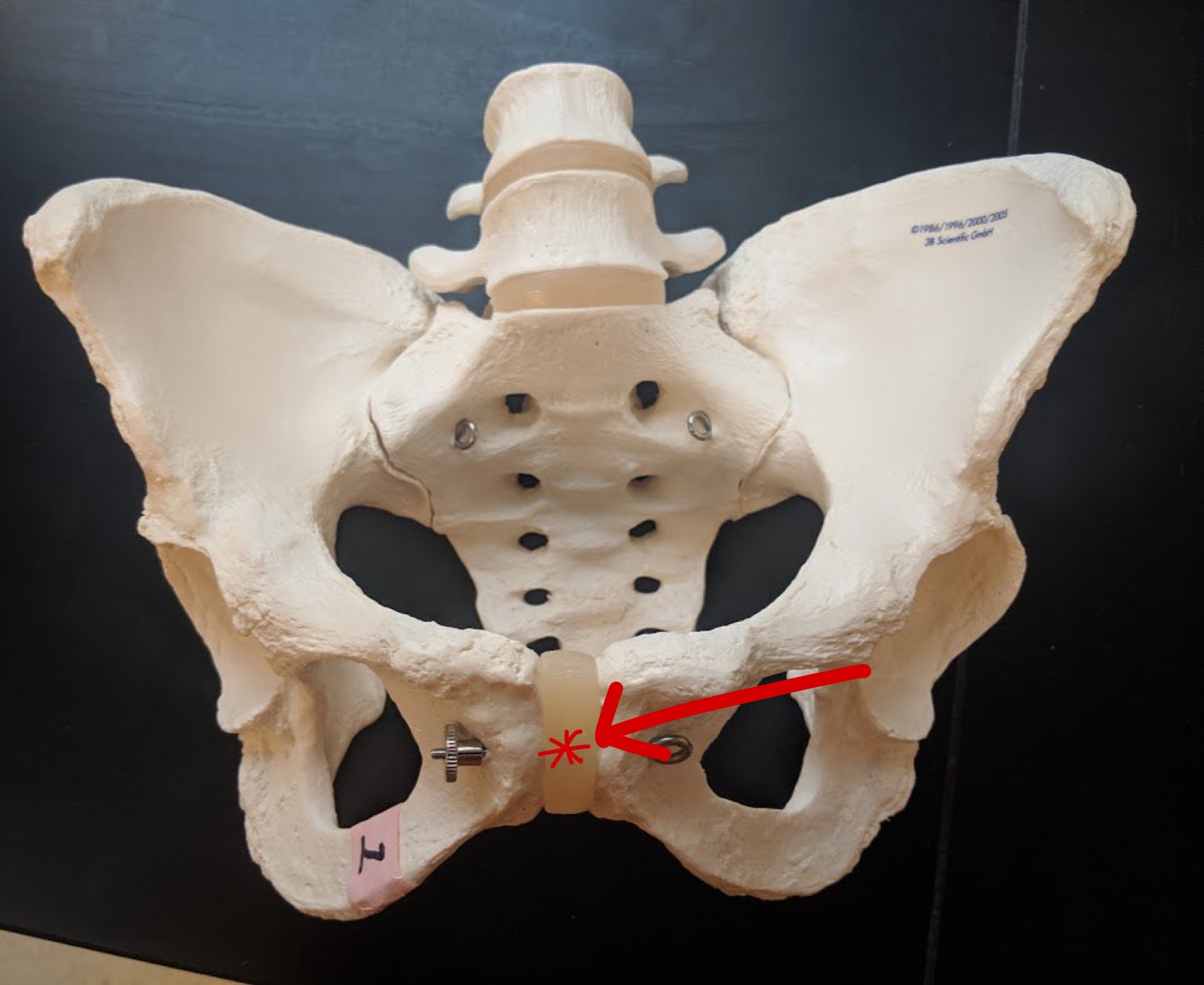 <p>Name this structure</p>