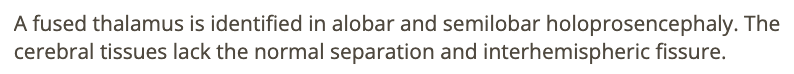 <p>d) alobar + semilobar holoprosencephaly</p>