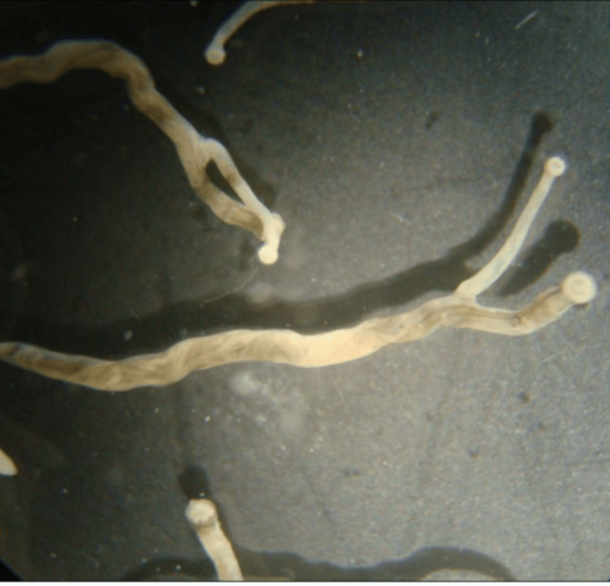 <p>What is this parasite? What characteristic/s did you use to identify it?</p>