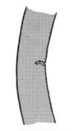 <p>What classification of fracture is this?</p>
