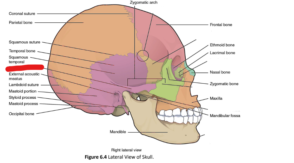 term image