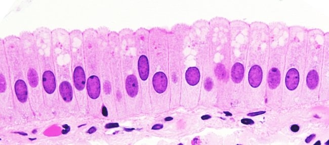 simple columnar