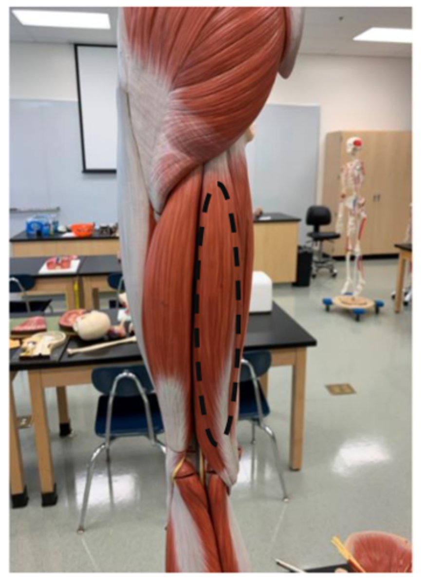 <p>posterior side (medial)</p>