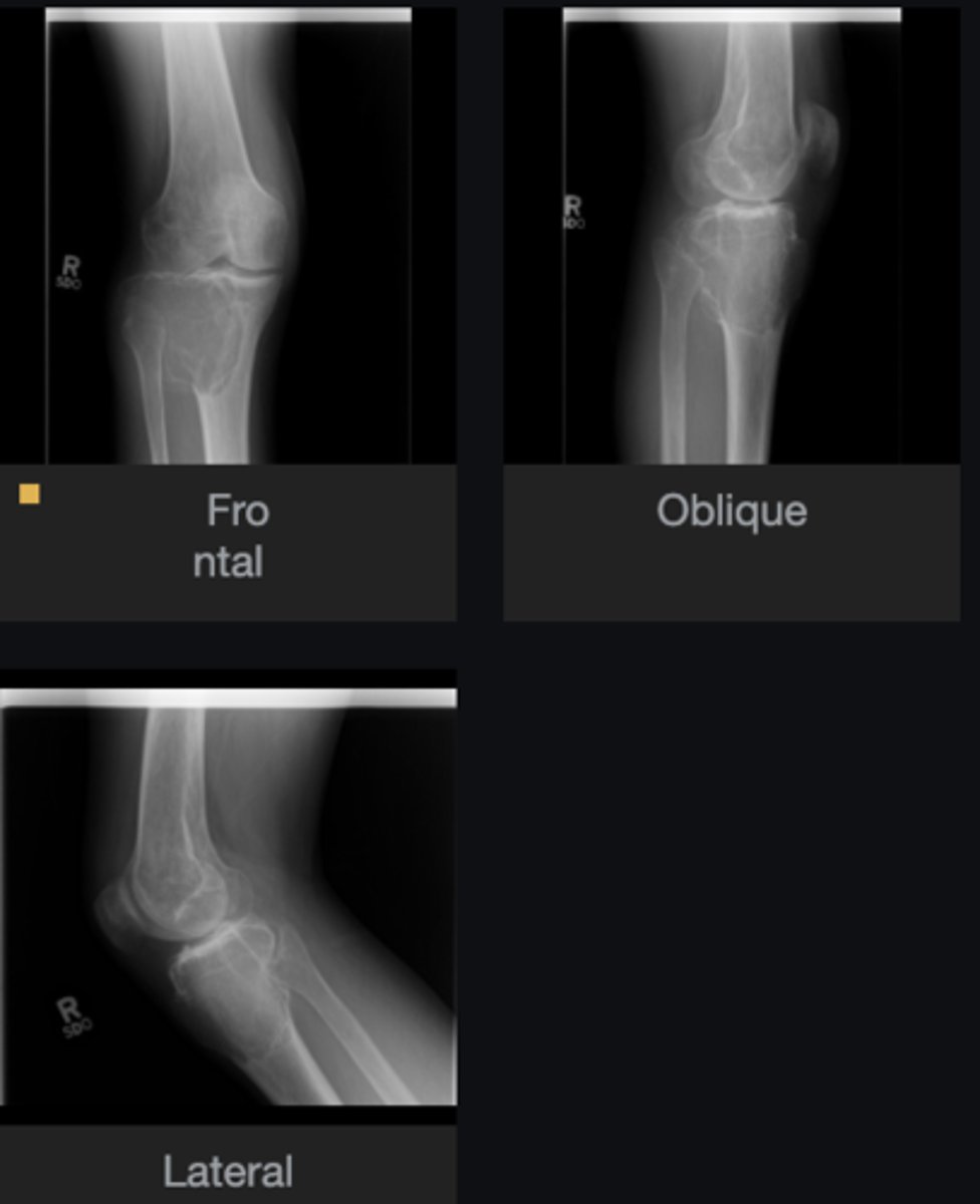 <p>Bone</p>