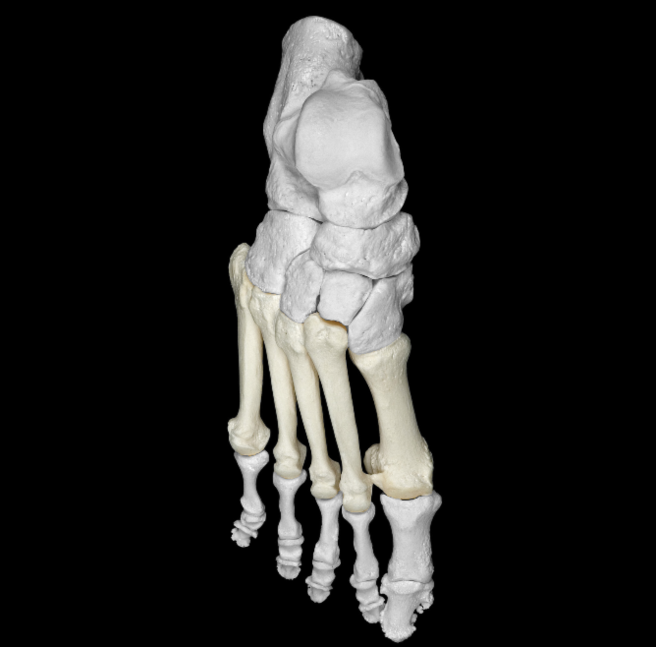 <p>metacarpals of the foot </p><p>I-V from medial-lateral </p>