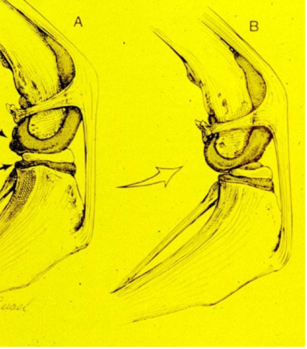<p>what is the "meniscal click"</p>