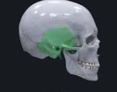 <p>What bone of the skull is this?</p>