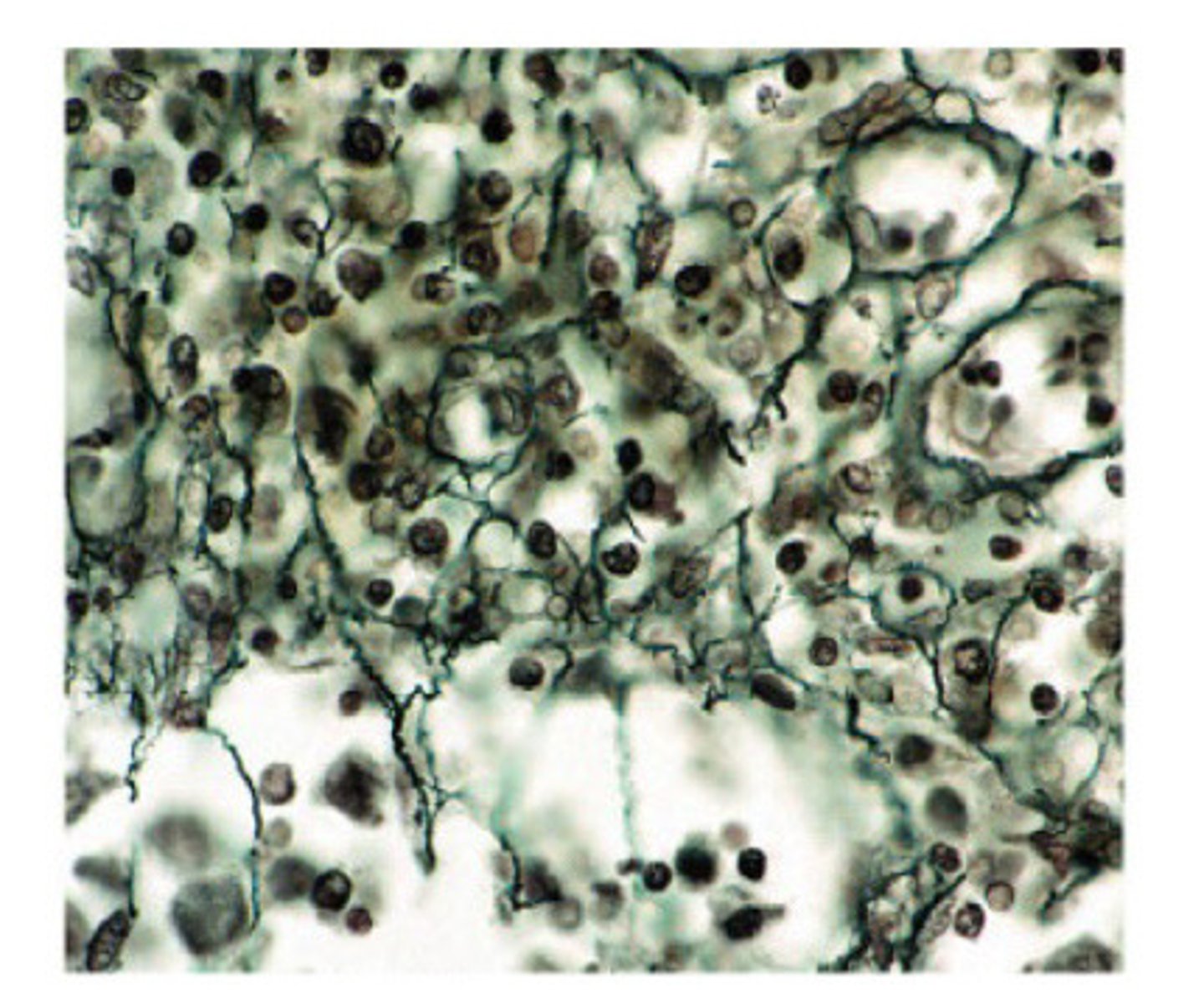<p>Reticular connective tissue</p>