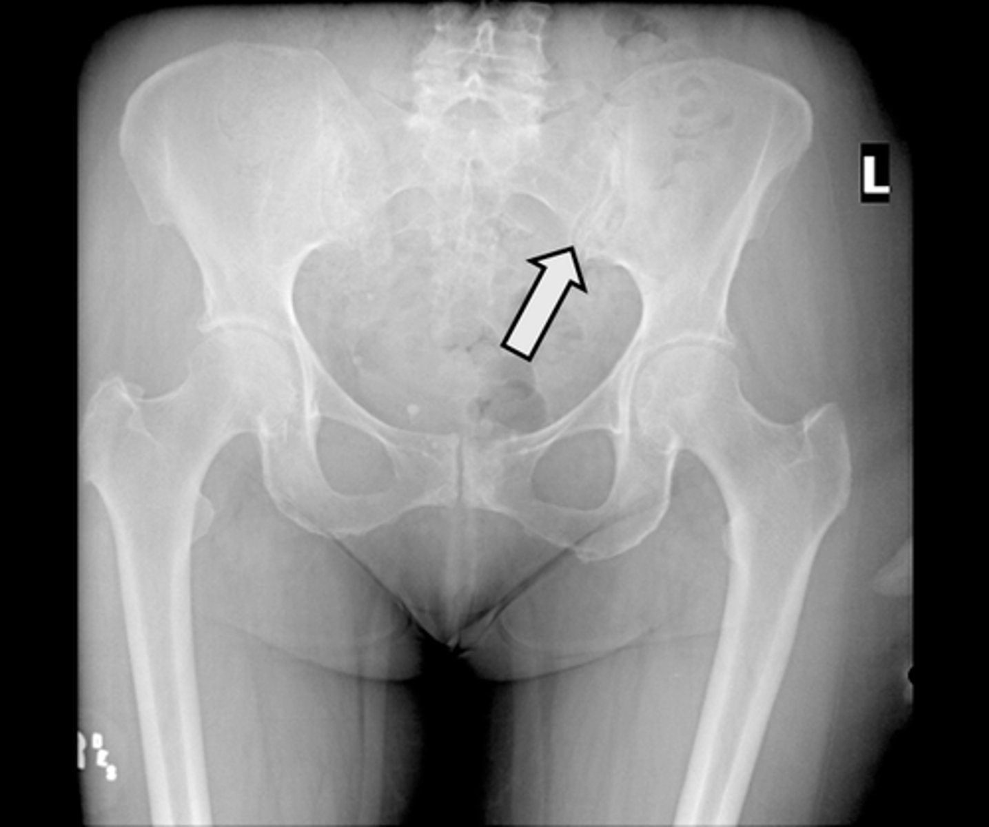 <p>What is indicated in the image?</p>