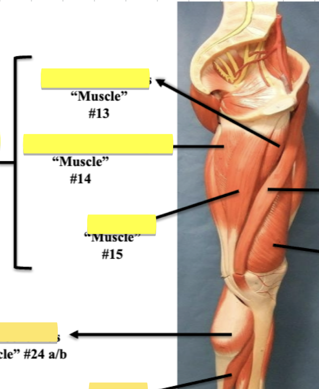 <p>Label muscle #14</p>