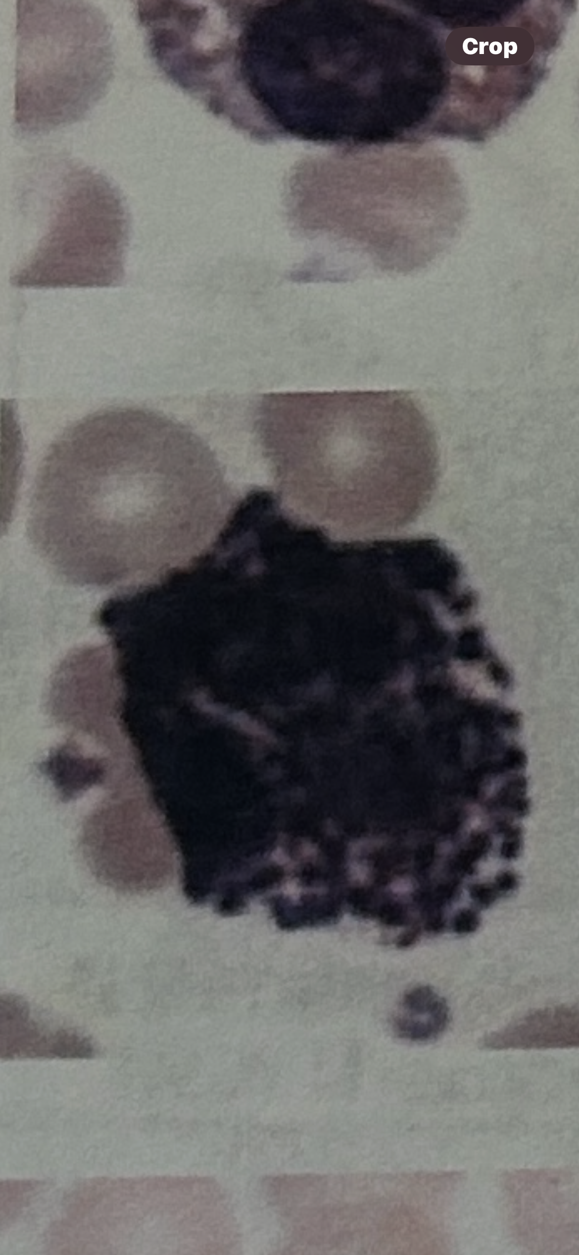 <p>WBC</p>