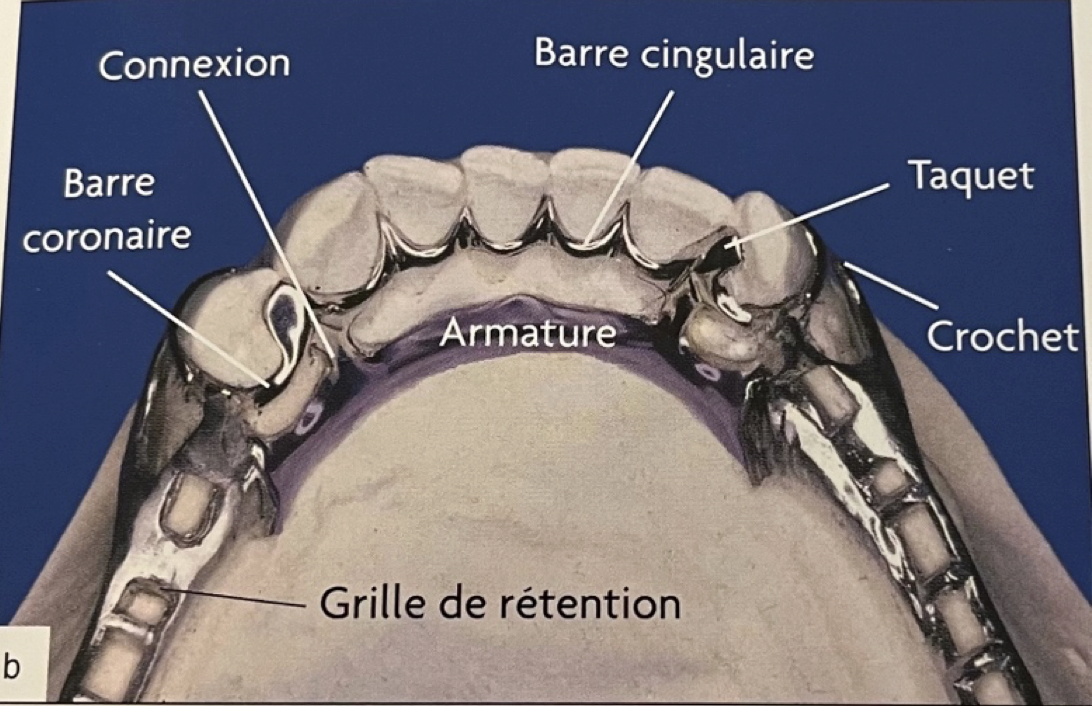 <ul><li><p>Relie l’élément de connexion principale aux éléments à appuis dentaire (connexions secondaires) </p></li><li><p>Transmission aux dents supports des forces exercées sur les selles </p></li></ul><p></p>