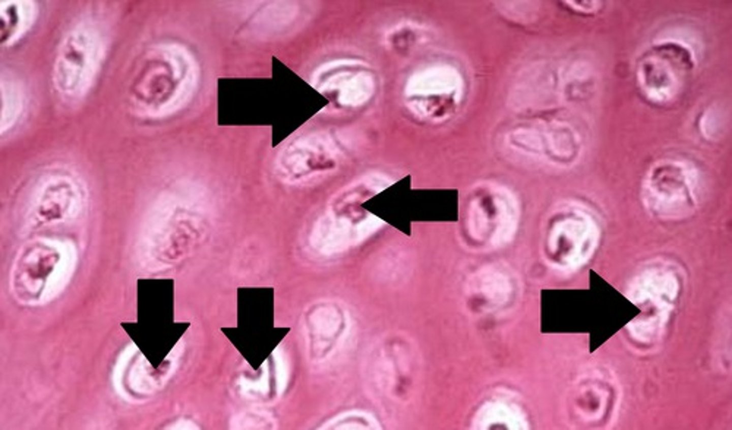 <p>mature cartilage cells that reside in lacunae</p>