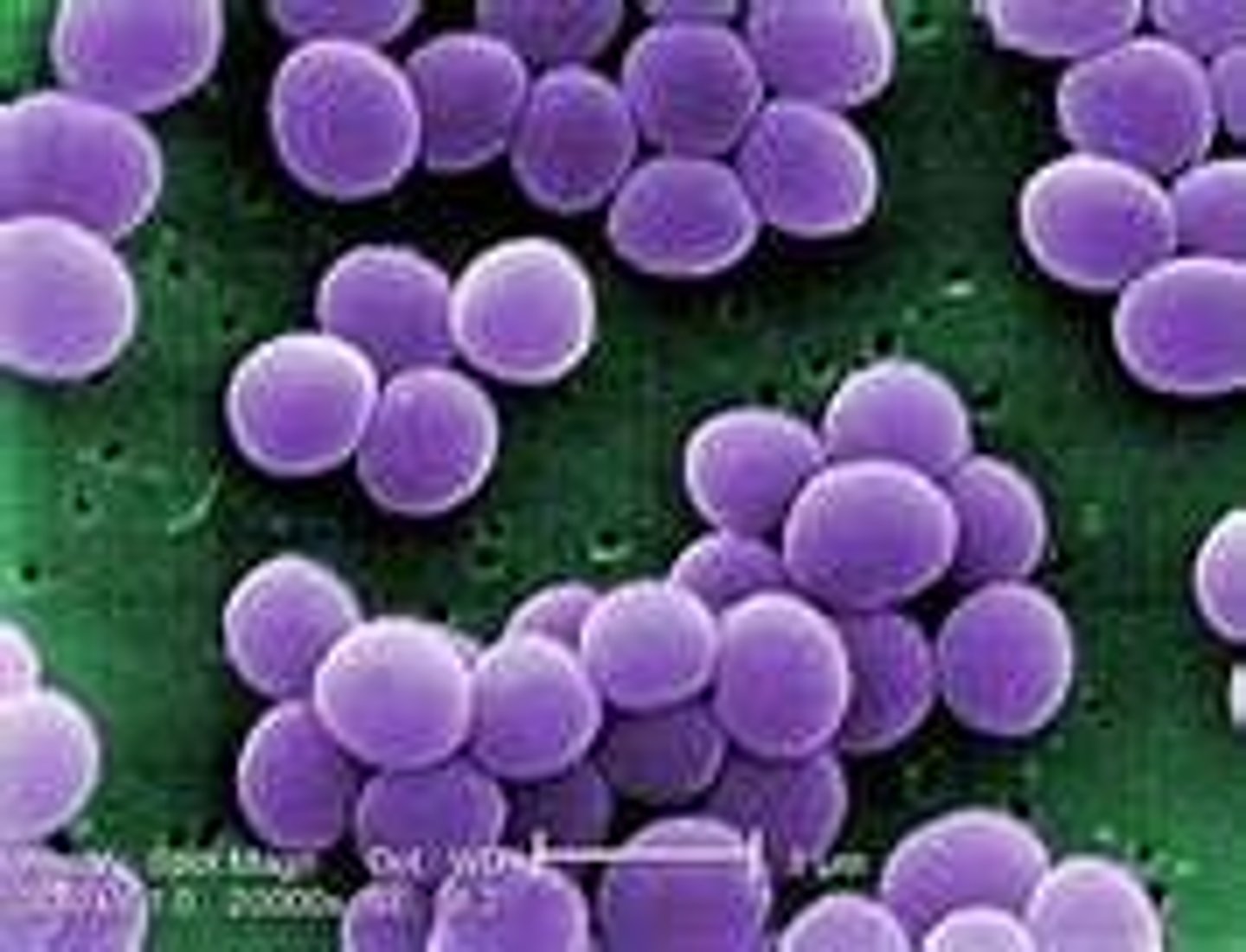 <p>pus-forming bacteria that grow in clusters like grapes. They cause abscesses, pustules, and boils.</p>
