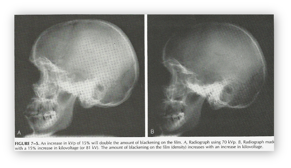 <p><span>It serves the technologist as a practical tool when changes in kV are necessary in order to control the amount of exposure to the image</span></p>