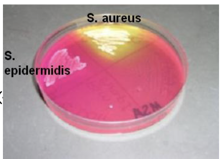 <p>Yellow indicates mannitol positive (+). No color change indicates mannitol negative (-)</p>