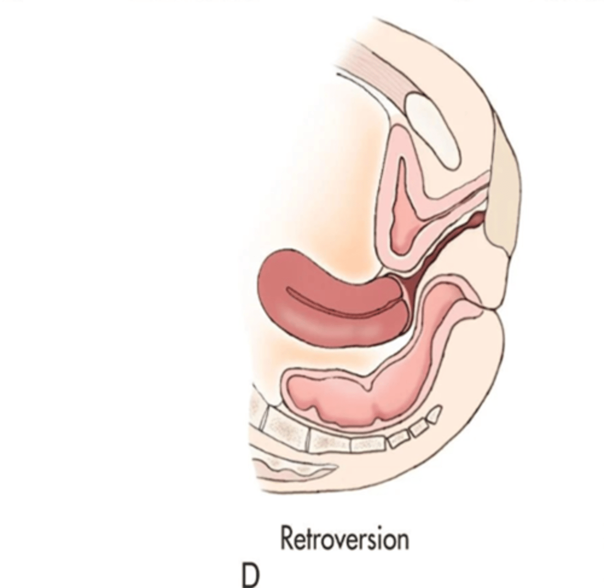 <p>fundus and body tilts backward, fundus and vagina are aligned </p>