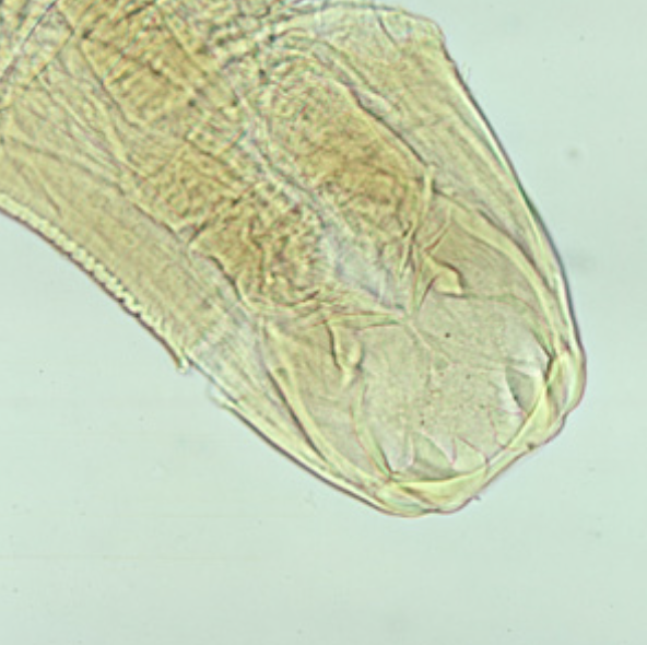 <p>4 teeth in mouth</p>